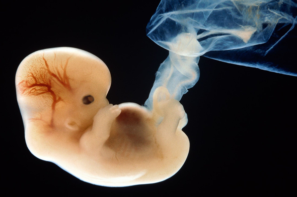 6 weeks human embryo