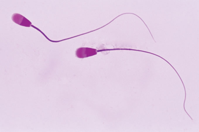 Sperm Cells