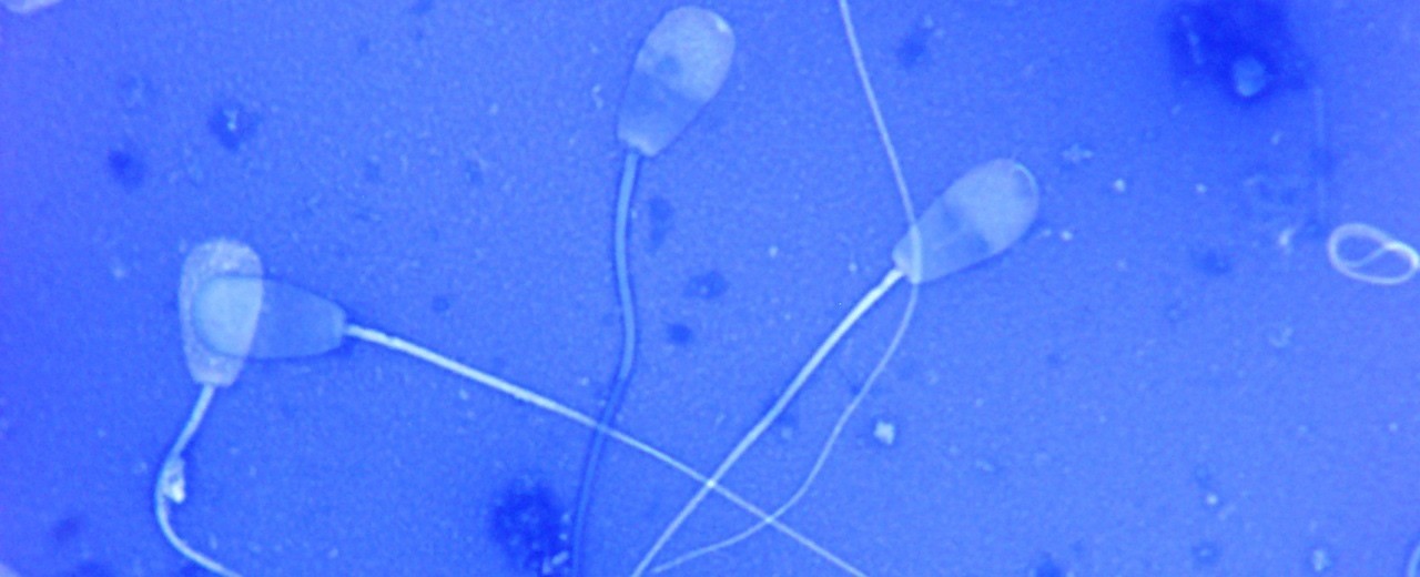 Sperm is reported to have been created for the first time in a laboratory