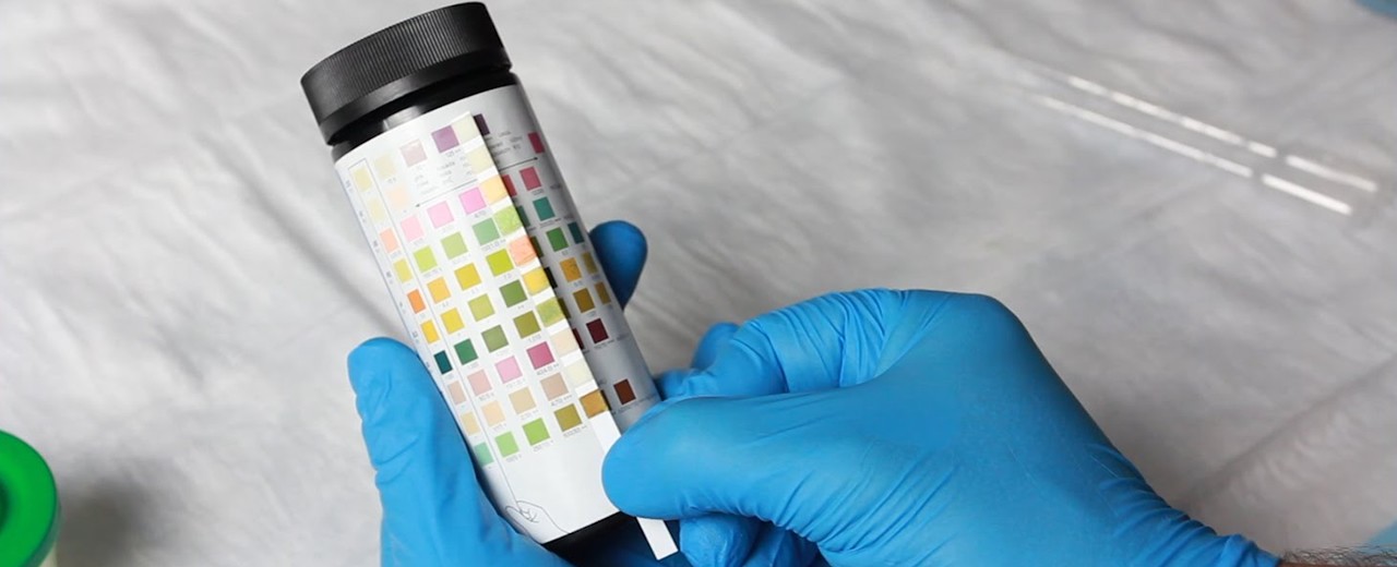 Urine analysis test - 11 parameters